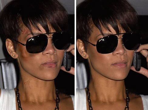 rihanna pictures after beating. RIHANNA PICTURES AFTER BEATING
