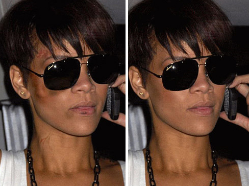 rihanna pictures after beating photos. rihanna beat up