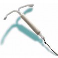 Mirena Insertion Experience and Review So to start, Mirena is an IUD (Intrauterine Device) contraceptive, which is also approved for the treatment of heavy periods. I was diagnosed with PMDD (Premenstrual Dysphoric Disorder). I’ve dealt...
